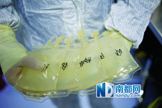 <p>&nbsp;&nbsp;&nbsp;&nbsp;經(jīng)過培養(yǎng)的細(xì)胞液最終要回輸?shù)交颊唧w內(nèi)。</p>